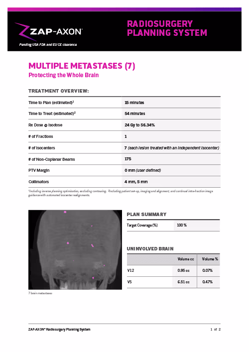 ZAP-Axon Large Multiple (7) Matastases Treatment Planning Studies
